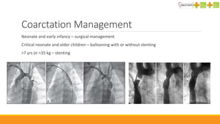 Coarctation Management
Neonate and early infancy – surgical management
Critical neonate and older children – ballooning with or without stenting
>7 yrs or >35 kg – stenting
 