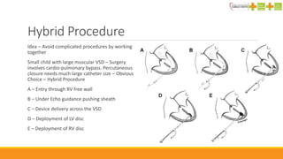 Hybrid Procedure
Idea – Avoid complicated procedures by working
together
Small child with large muscular VSD – Surgery
involves cardio-pulmonary bypass. Percutaneous
closure needs much large catheter size – Obvious
Choice – Hybrid Procedure
A – Entry through RV free wall
B – Under Echo guidance pushing sheath
C – Device delivery across the VSD
D – Deployment of LV disc
E – Deployment of RV disc
 