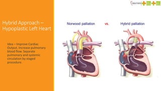 Hybrid Approach –
Hypoplastic Left Heart
Idea – Improve Cardiac
Output. Increase pulmonary
blood flow. Separate
pulmonary and systemic
circulation by staged
procedure.
 