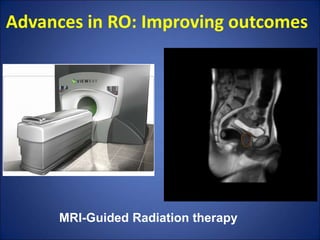 Advances in radiation oncology:Cancer care | PPTX