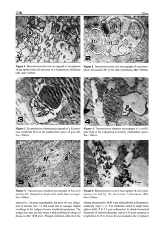238 Jifang
Figure 1. Transmission electron micrograph of cytoplasma
of gut epithelium cells infected by a filamentous mollicute
(M). Bar=200nm.
Figure 2. Transmission electron micrograph of a pleomor-
phous mollicute (M) in the cell cytoplasma. Bar=200nm.
Figure 3. Transmission electron micrograph of a filamen-
tous mollicute (M) in the perinuclear space of gut cell.
Bar=500nm.
Figure 4. Transmission electron micrograph of a molli-
cute (M) in the expanding extremely perinuclear space.
Bar=500nm.
Figure 5. Transmission electron micrograph of host cell
nucleus (N) changed in shape with multi-trace-strangle.
Bar=500nm.
Figure 6. Transmission electron micrograph of cell cytop-
lasma severed by the mollicute filamentous (M).
Bar=200nm.
about 80%. On gross examination, the most obvious indica-
tion of disease was 1-3 red, knob like to sausage shaped
swellings in the midgut of some moribund specimens. The
midgut was also the only tissue which exhibited evidence of
disease at the TEM level. Midgut epithelial cells of all the
shrimp examined by TEM were infected with a filamentous
mollicute (Figs. 1, 2). The mollicute varied in shape from
spherical (0.12 to 1.2 µm in diameter) to slender branched
filaments of uniform diameter (about 0.09 µm), ranging in
length from 0.25 to 14 µm. It was located in the cytoplasm
 