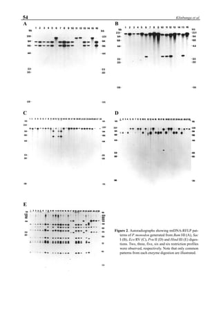 54 Klinbunga et al.
Figure 2. Autoradiographs showing mtDNA-RFLP pat-
terns of P. monodon generated from Bam HI (A), Sac
I (B), Eco RV (C), Pvu II (D) and Hind III (E) diges-
tions. Two, three, five, six and six restriction profiles
were observed, respectively. Note that only common
patterns from each enzyme digestion are illustrated.
A B
C D
E
 