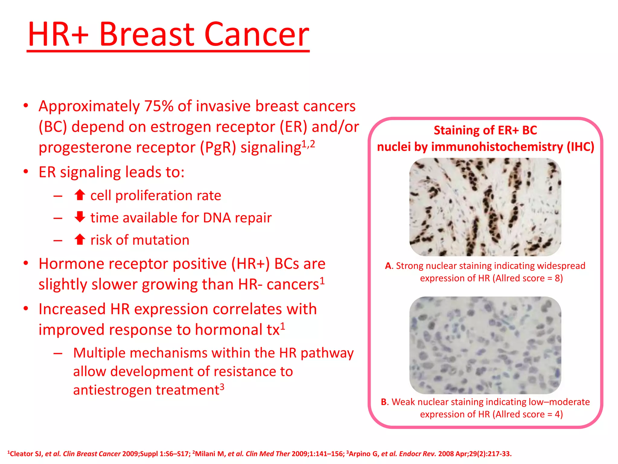 Advances in the management of breast cancer | PPTX