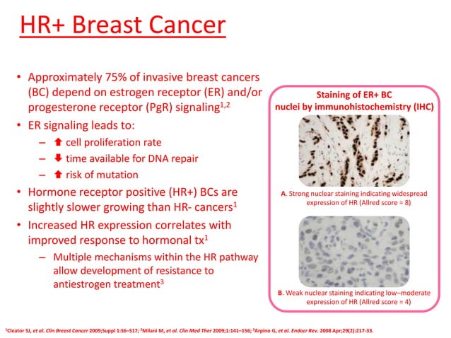 Advances in the management of breast cancer | PPTX | Cancer | Diseases ...