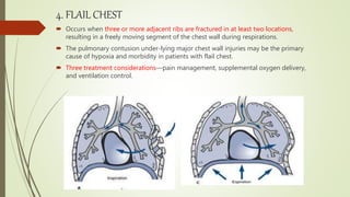 4. FLAIL CHEST
 Occurs when three or more adjacent ribs are fractured in at least two locations,
resulting in a freely moving segment of the chest wall during respirations.
 The pulmonary contusion under-lying major chest wall injuries may be the primary
cause of hypoxia and morbidity in patients with flail chest.
 Three treatment considerations—pain management, supplemental oxygen delivery,
and ventilation control.
 