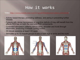 Video: http://www.youtube.com/watch?v=gcadj18Dsjc&feature=player_embedded#!
• Activity based therapy, promoting wellness, and aiding in preventing further
disease
• Patients with dense hemiparesis or cognitive deficits of may still benefit from the
effects FES has on both the cord and PNS components.
• Controlled stimulation patterns sent to arms, shoulder and trunk through
electrodes, producing a smooth cycling motion
• 30 minute sessions at least 3 X/ week
• Stimulate up to 10 muscle groups in one or both legs or arms and the trunk
 