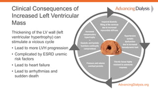 AdvancingDialysis.org
Clinical Consequences of
Increased Left Ventricular
Mass
Thickening of the LV wall (left
ventricular...