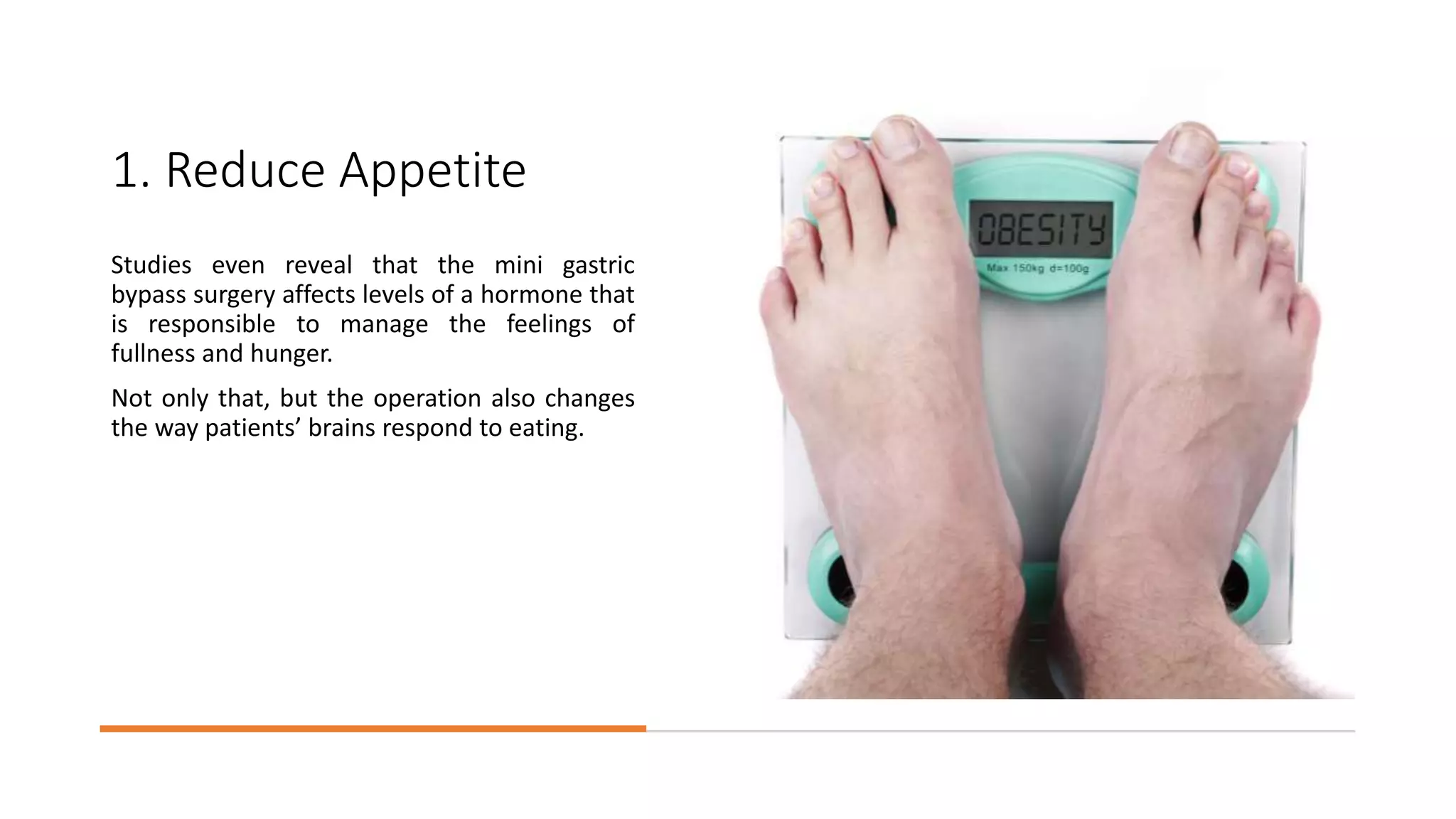 Advantages and Disadvantages of Mini Gastric Bypass Surgery | PPTX