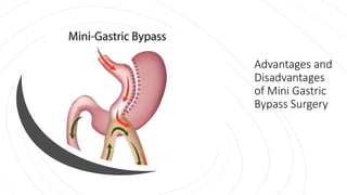 Advantages and
Disadvantages
of Mini Gastric
Bypass Surgery
 
