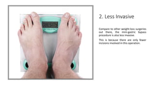 Advantages and Disadvantages of Mini Gastric Bypass Surgery | PPTX
