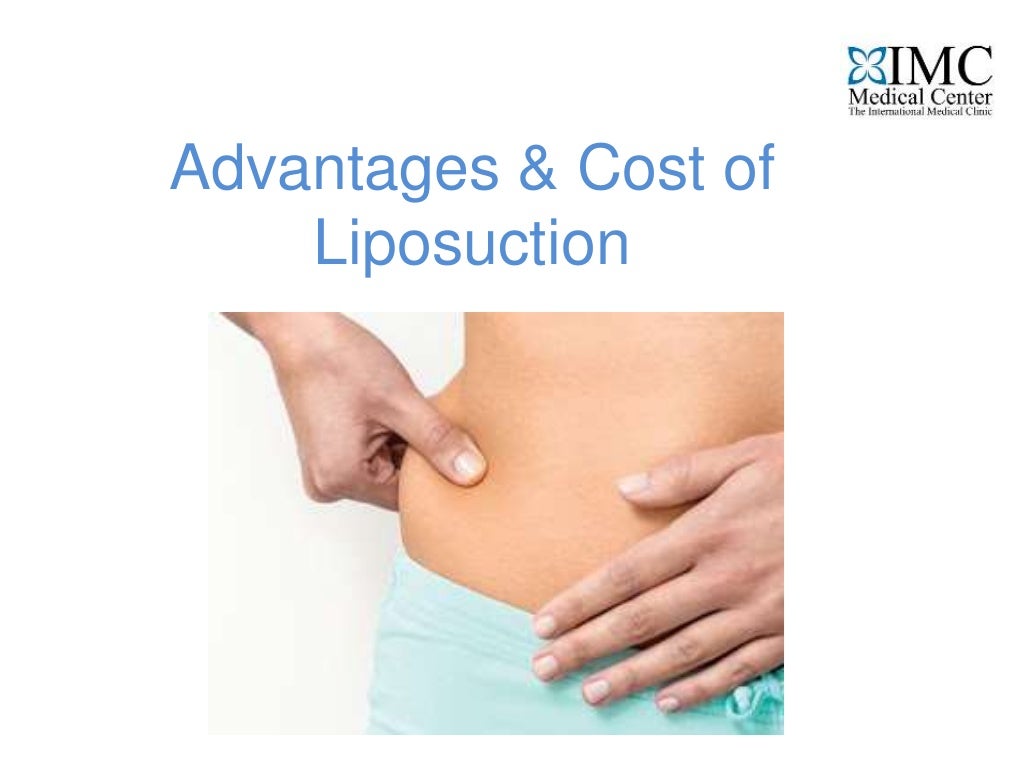 Advantages & cost of liposuction