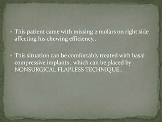  This patient came with missing 2 molars on right side
affecting his chewing efficiency..
 This situation can be comfortably treated with basal
compressive implants , which can be placed by
NONSURGICAL FLAPLESS TECHNIQUE..
 