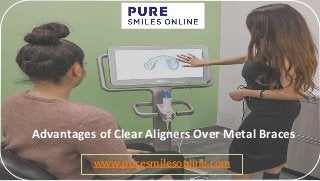 Advantages of Clear Aligners Over Metal Braces
www.puresmilesonline.com
 