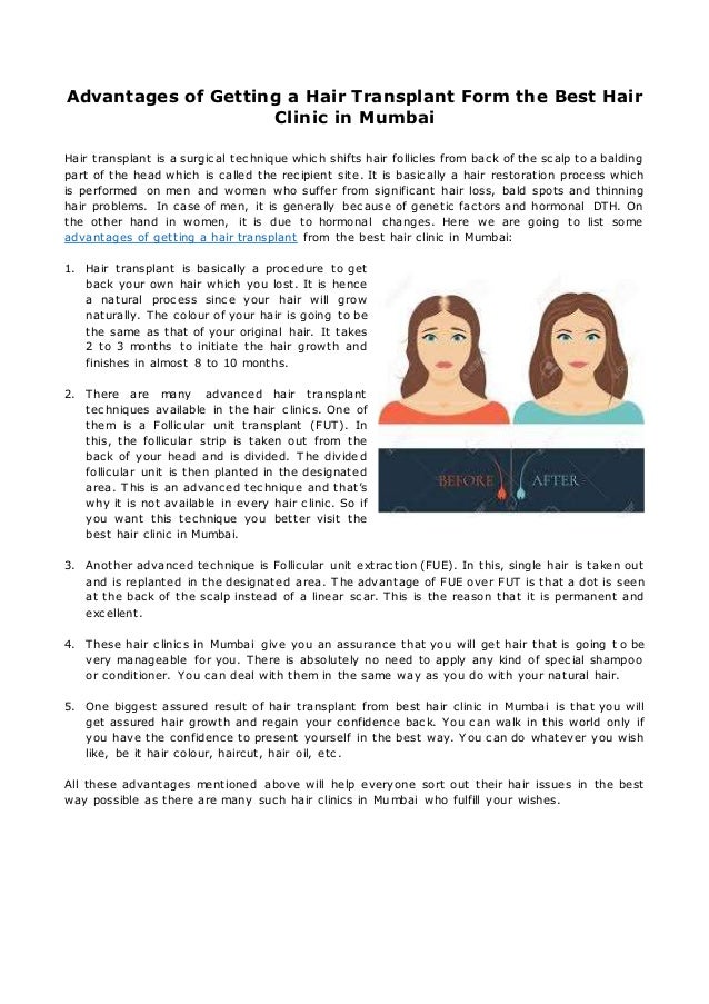 Advantages Of Getting A Hair Transplant Form The Best Hair Clinic In