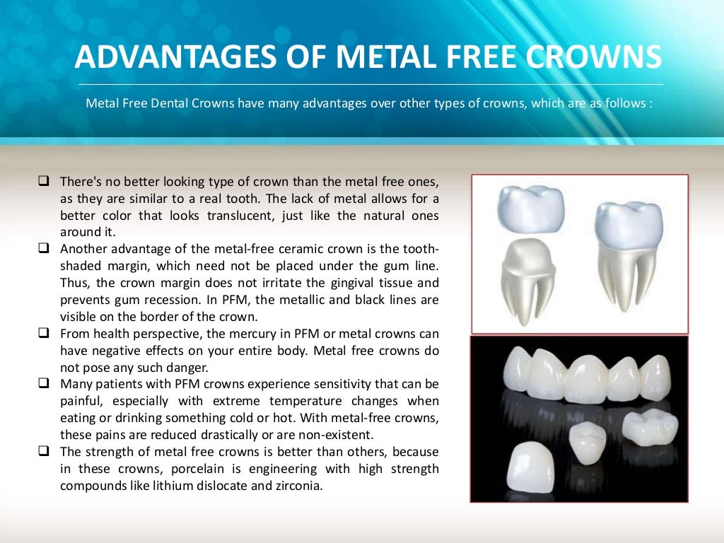 Advantages of metal free crown treatment