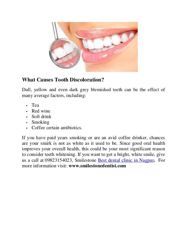 Advantages Of Teeth Whitening Advantages Of Teeth Whitening