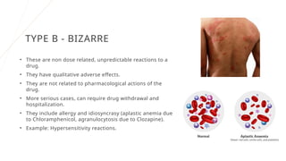 Adverse Example Drawing Adverse drug reactions.pptx powerpoint science | PPTX