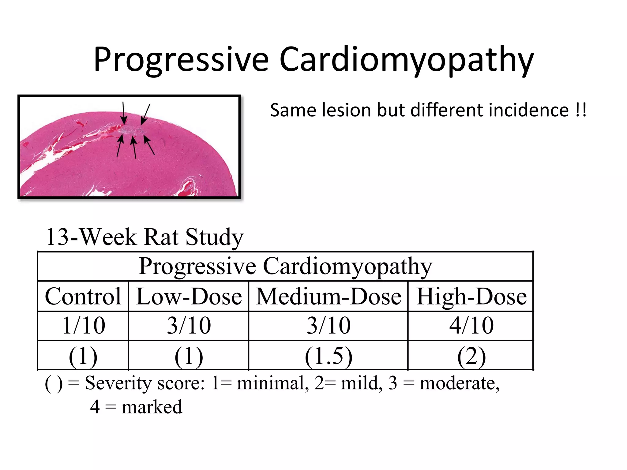 Progressive Cardiomyopathy
13-Week Rat Study
Progressive Cardiomyopathy
Control Low-Dose Medium-Dose High-Dose
1/10 3/10 3/10 4/10
(1) (1) (1.5) (2)
( ) = Severity score: 1= minimal, 2= mild, 3 = moderate,
4 = marked
Same lesion but different incidence !!
 