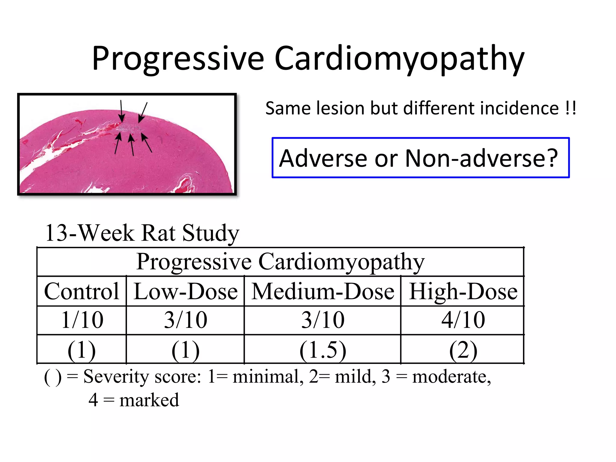 Progressive Cardiomyopathy
13-Week Rat Study
Progressive Cardiomyopathy
Control Low-Dose Medium-Dose High-Dose
1/10 3/10 3/10 4/10
(1) (1) (1.5) (2)
( ) = Severity score: 1= minimal, 2= mild, 3 = moderate,
4 = marked
Adverse or Non-adverse?
Same lesion but different incidence !!
 