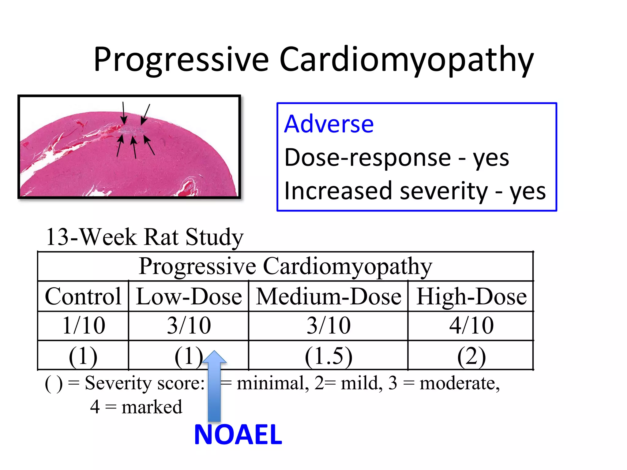 Progressive Cardiomyopathy
13-Week Rat Study
Progressive Cardiomyopathy
Control Low-Dose Medium-Dose High-Dose
1/10 3/10 3/10 4/10
(1) (1) (1.5) (2)
( ) = Severity score: 1= minimal, 2= mild, 3 = moderate,
4 = marked
Adverse
Dose-response - yes
Increased severity - yes
NOAEL
 