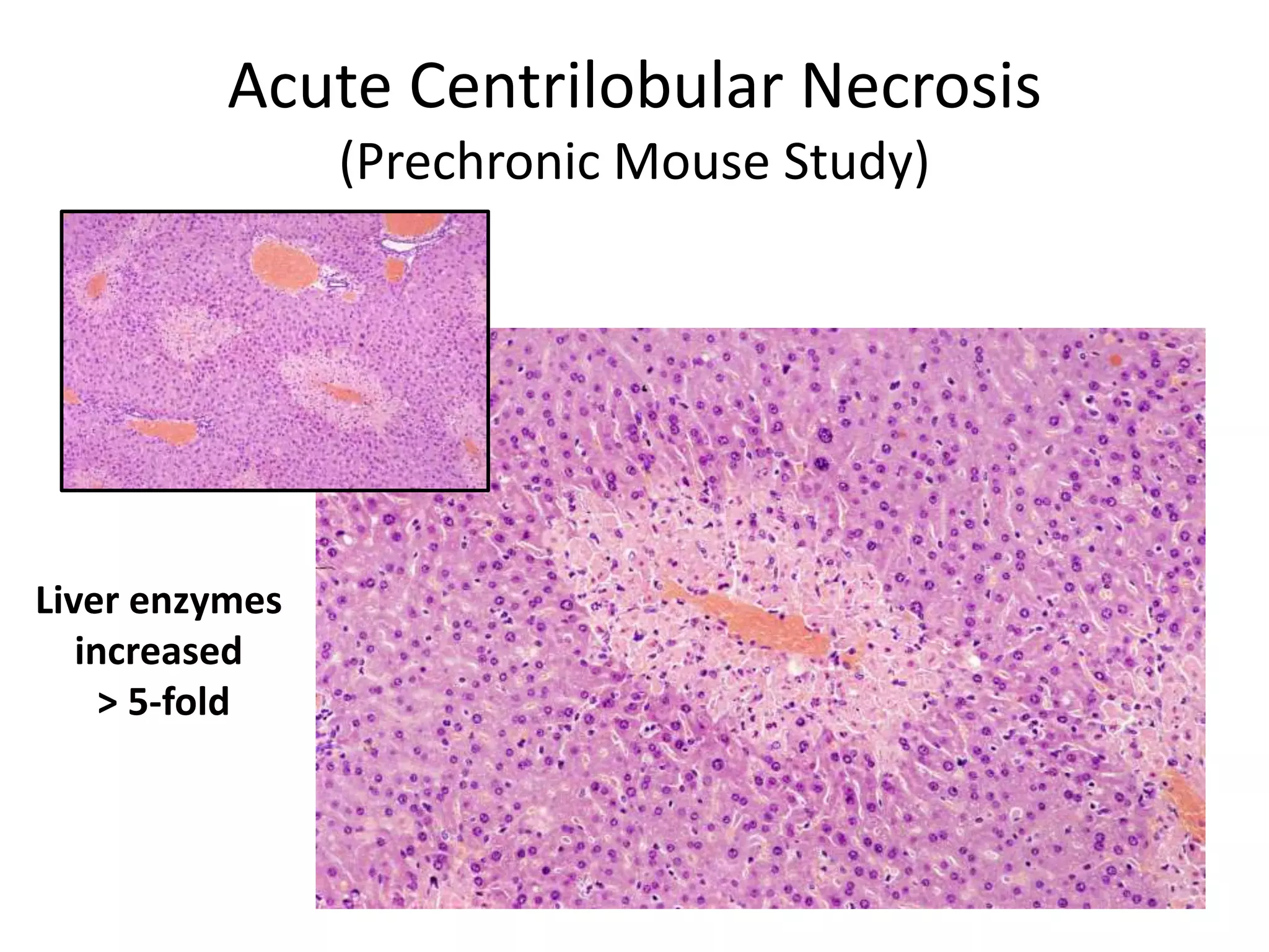 Acute Centrilobular Necrosis
(Prechronic Mouse Study)
Liver enzymes
increased
> 5-fold
 