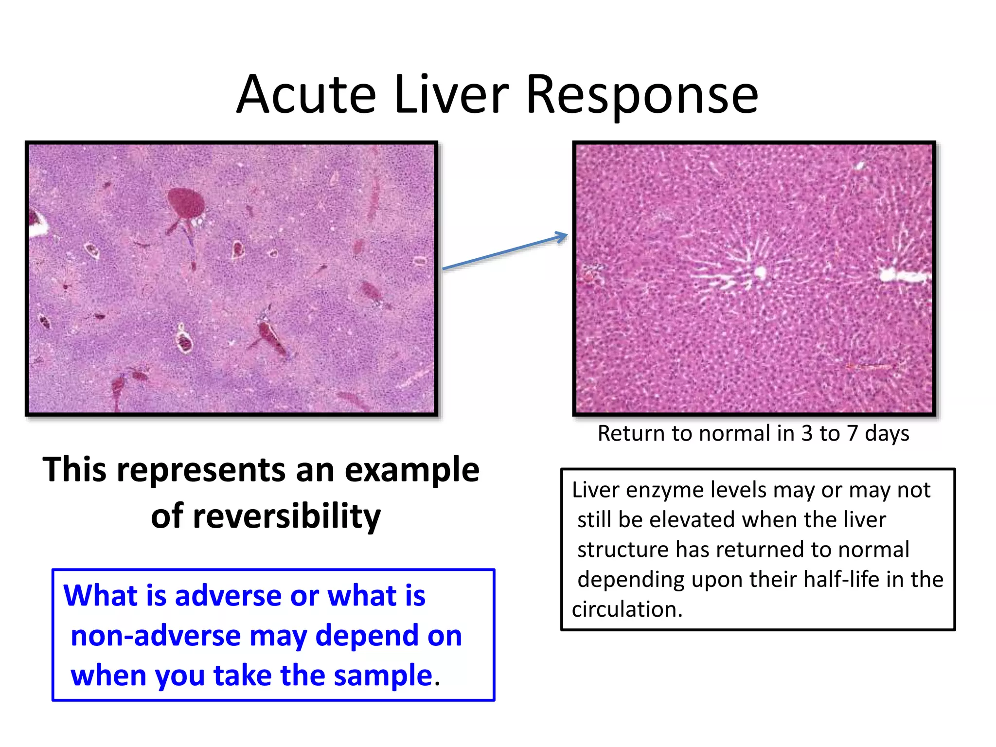 Acute Liver Response
Return to normal in 3 to 7 days
Liver enzyme levels may or may not
still be elevated when the liver
structure has returned to normal
depending upon their half-life in the
circulation.What is adverse or what is
non-adverse may depend on
when you take the sample.
This represents an example
of reversibility
 