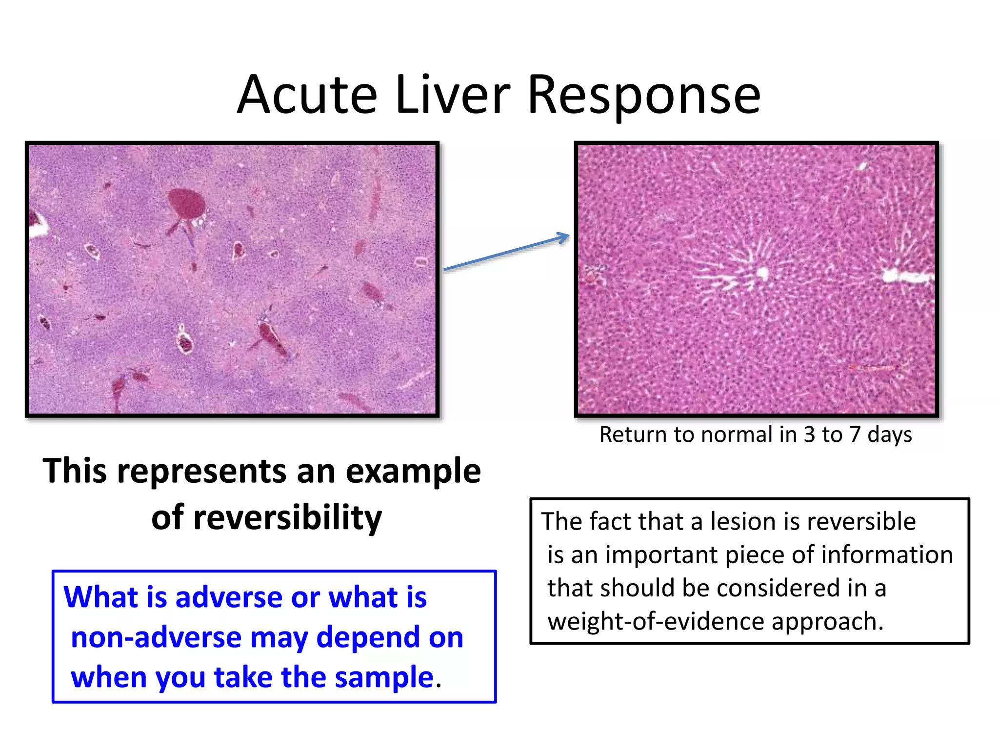 Acute Liver Response
Return to normal in 3 to 7 days
What is adverse or what is
non-adverse may depend on
when you take the sample.
This represents an example
of reversibility The fact that a lesion is reversible
is an important piece of information
that should be considered in a
weight-of-evidence approach.
 