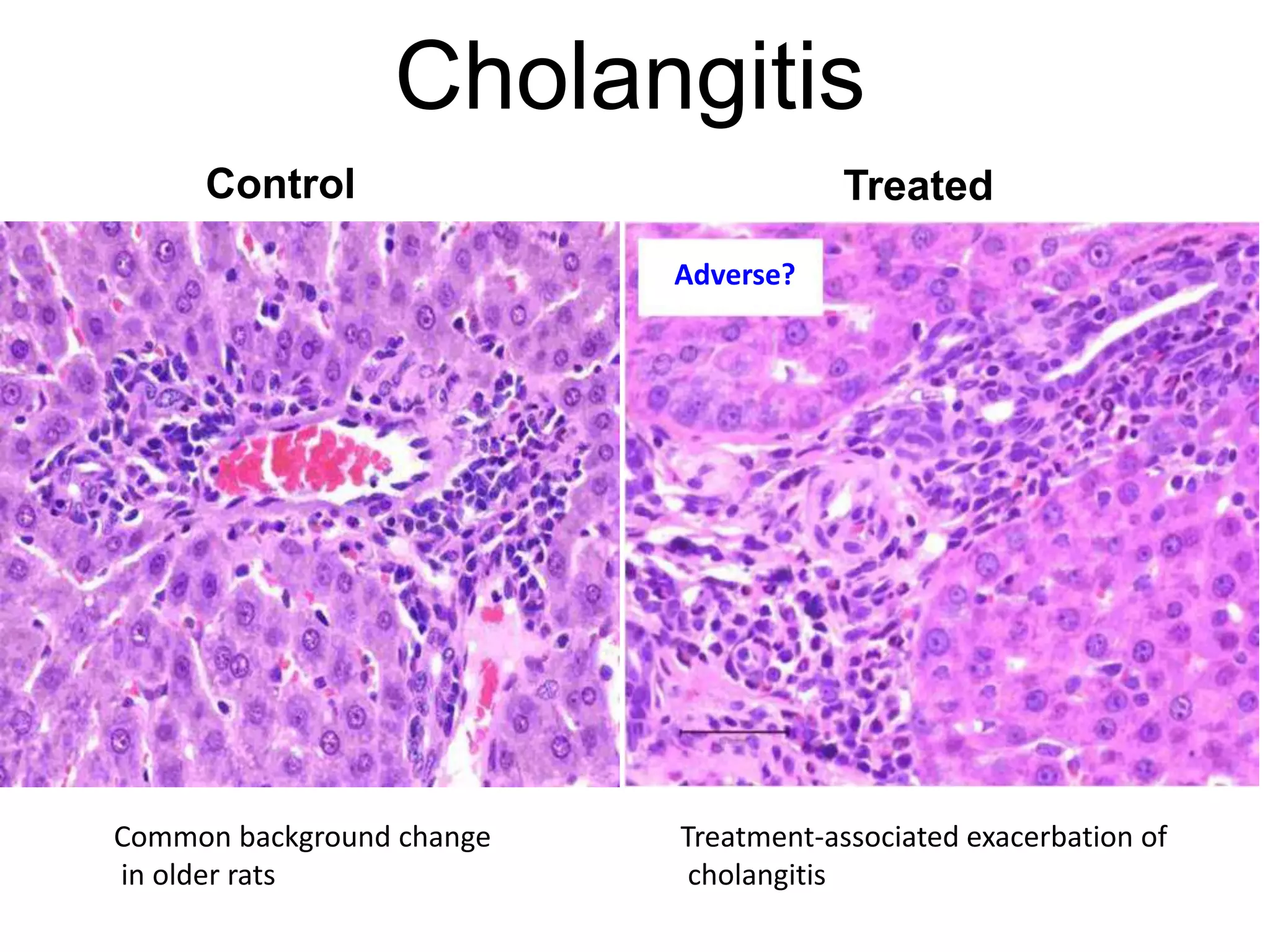 Cholangitis
Control Treated
Treatment-associated exacerbation of
cholangitis
Common background change
in older rats
Adverse?
 