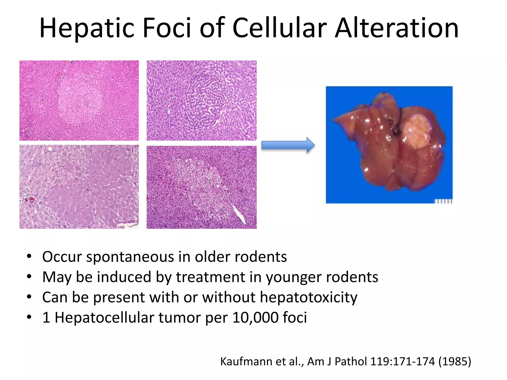 Hepatic Foci of Cellular Alteration
• Occur spontaneous in older rodents
• May be induced by treatment in younger rodents
• Can be present with or without hepatotoxicity
• 1 Hepatocellular tumor per 10,000 foci
Kaufmann et al., Am J Pathol 119:171-174 (1985)
 