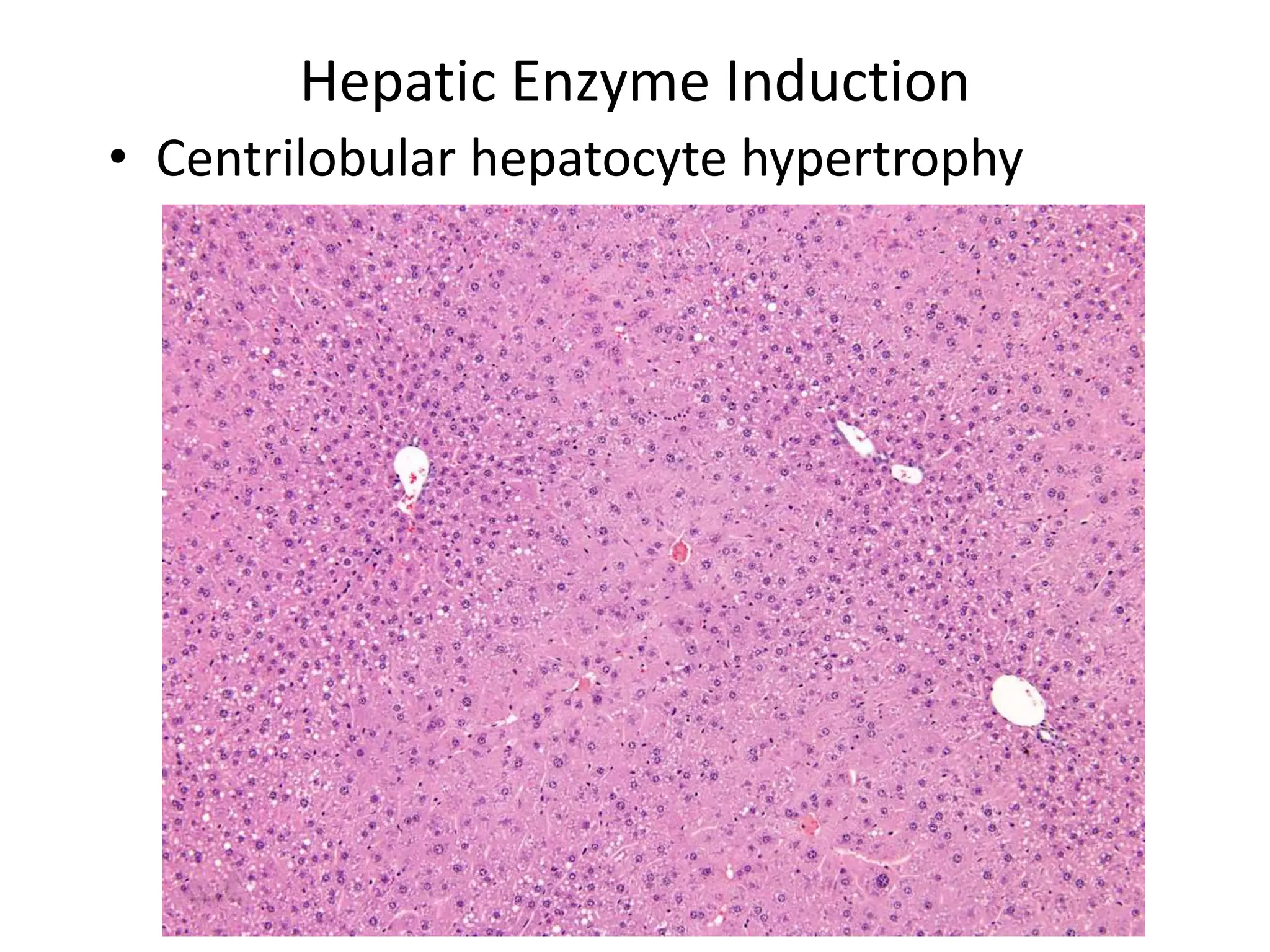Hepatic Enzyme Induction
• Centrilobular hepatocyte hypertrophy
 