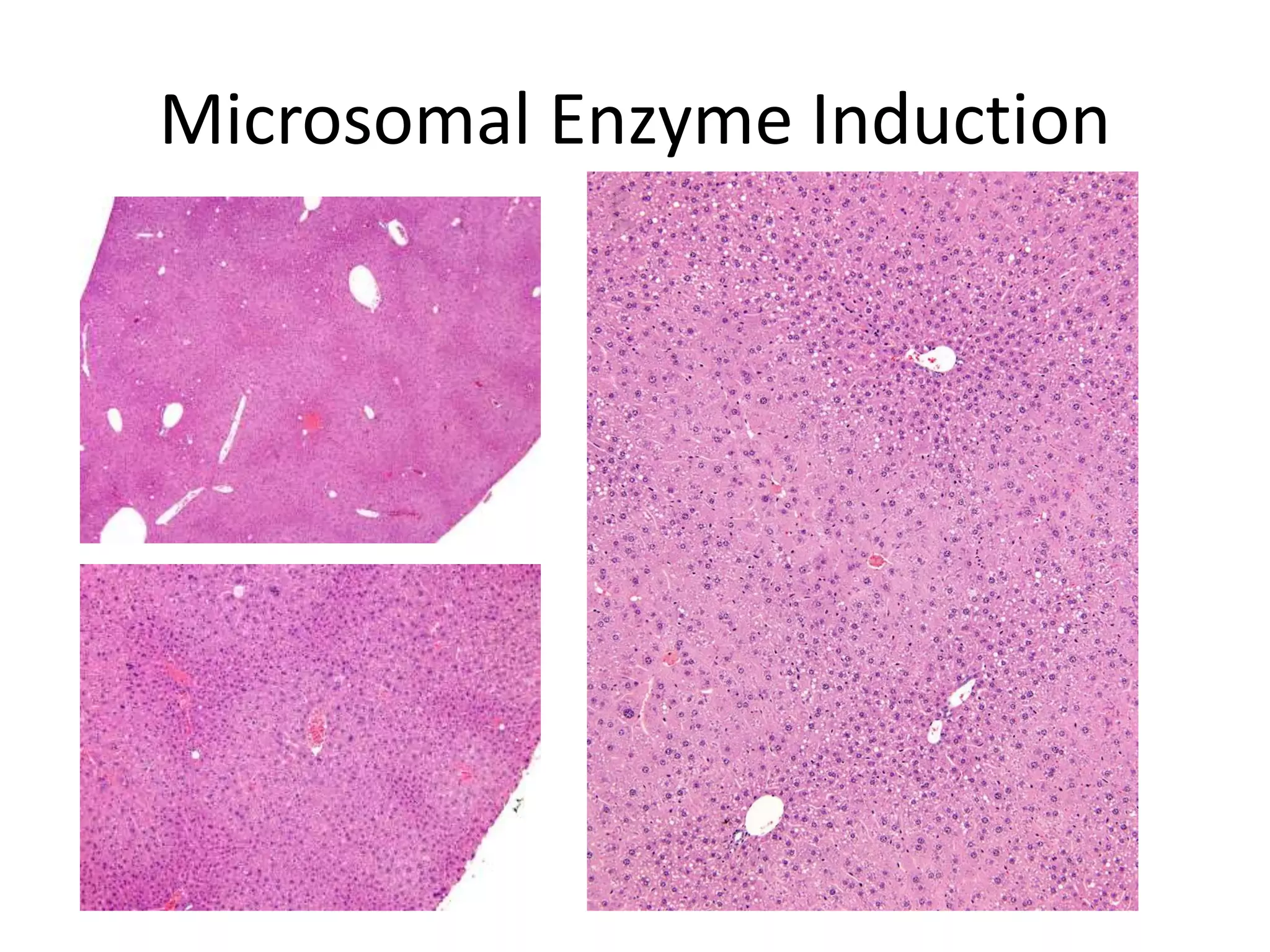 Microsomal Enzyme Induction
 