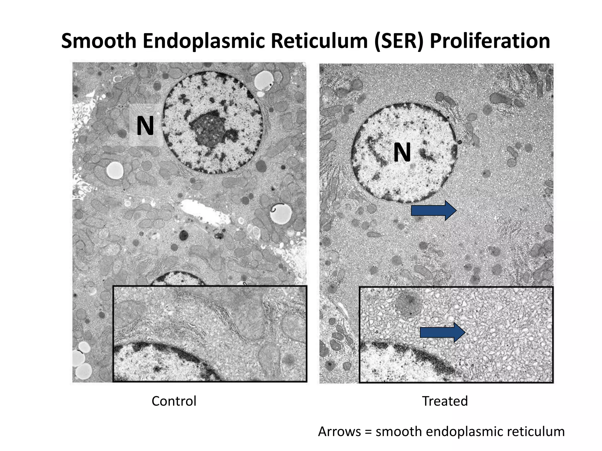 N
N
Smooth Endoplasmic Reticulum (SER) Proliferation
Control Treated
Arrows = smooth endoplasmic reticulum
 