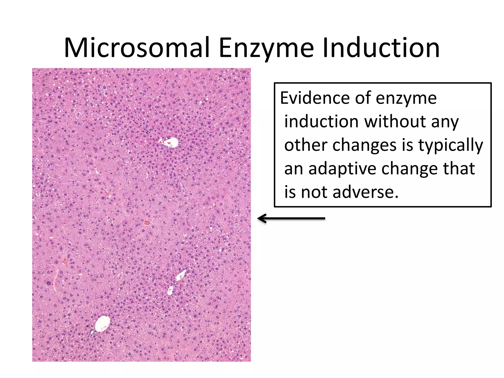 Microsomal Enzyme Induction
Evidence of enzyme
induction without any
other changes is typically
an adaptive change that
is not adverse.
 