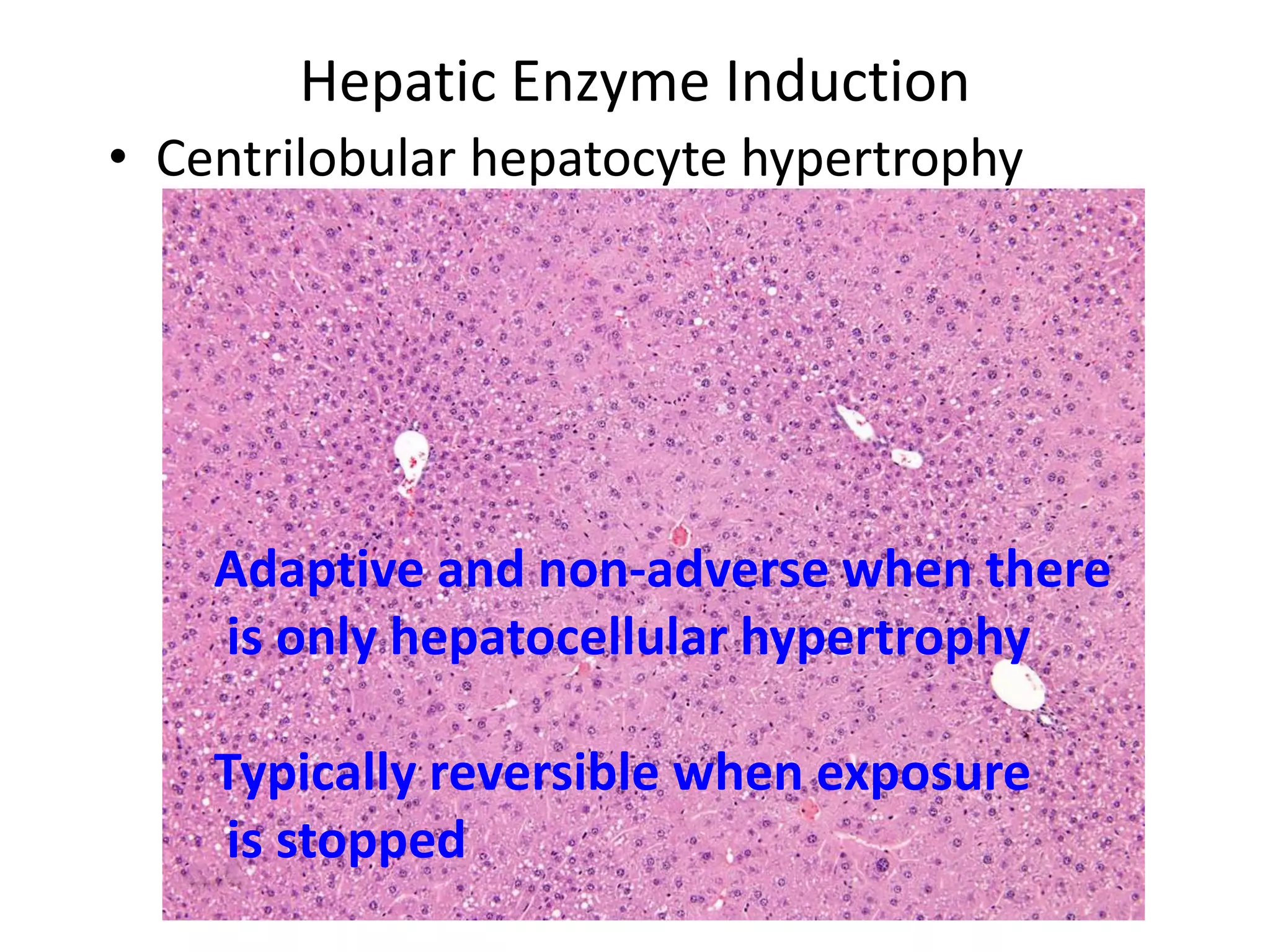 Hepatic Enzyme Induction
• Centrilobular hepatocyte hypertrophy
Adaptive and non-adverse when there
is only hepatocellular hypertrophy
Typically reversible when exposure
is stopped
 