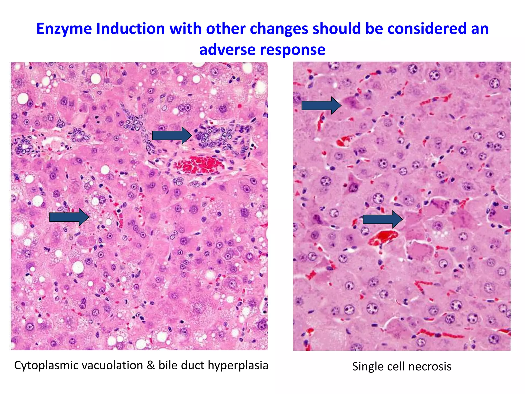 Enzyme Induction with other changes should be considered an
adverse response
Cytoplasmic vacuolation & bile duct hyperplasia Single cell necrosis
 