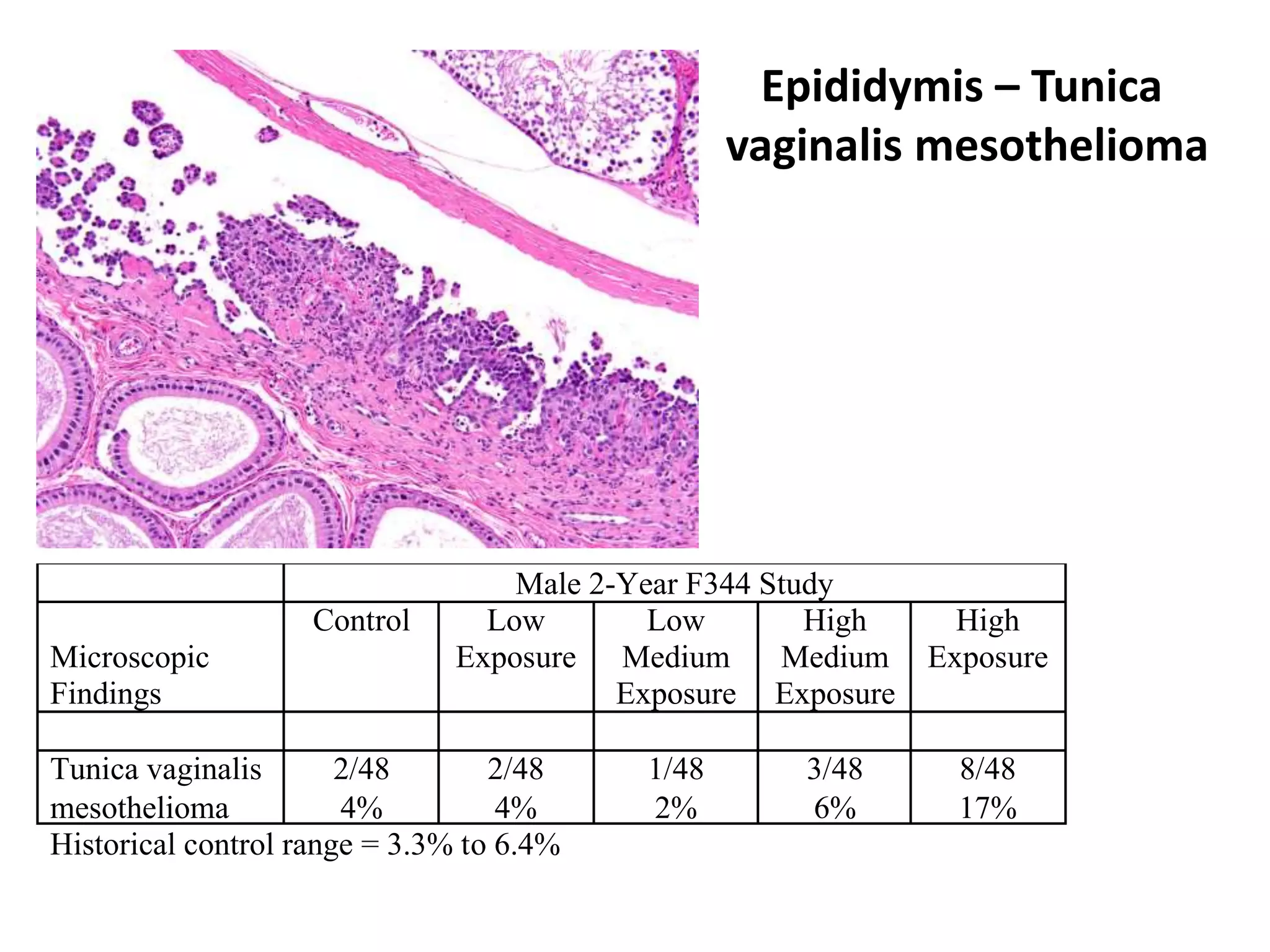 Epididymis – Tunica
vaginalis mesothelioma
Male 2-Year F344 Study
Microscopic
Findings
Control Low
Exposure
Low
Medium
Exposure
High
Medium
Exposure
High
Exposure
Tunica vaginalis
mesothelioma
2/48
4%
2/48
4%
1/48
2%
3/48
6%
8/48
17%
Historical control range = 3.3% to 6.4%
 