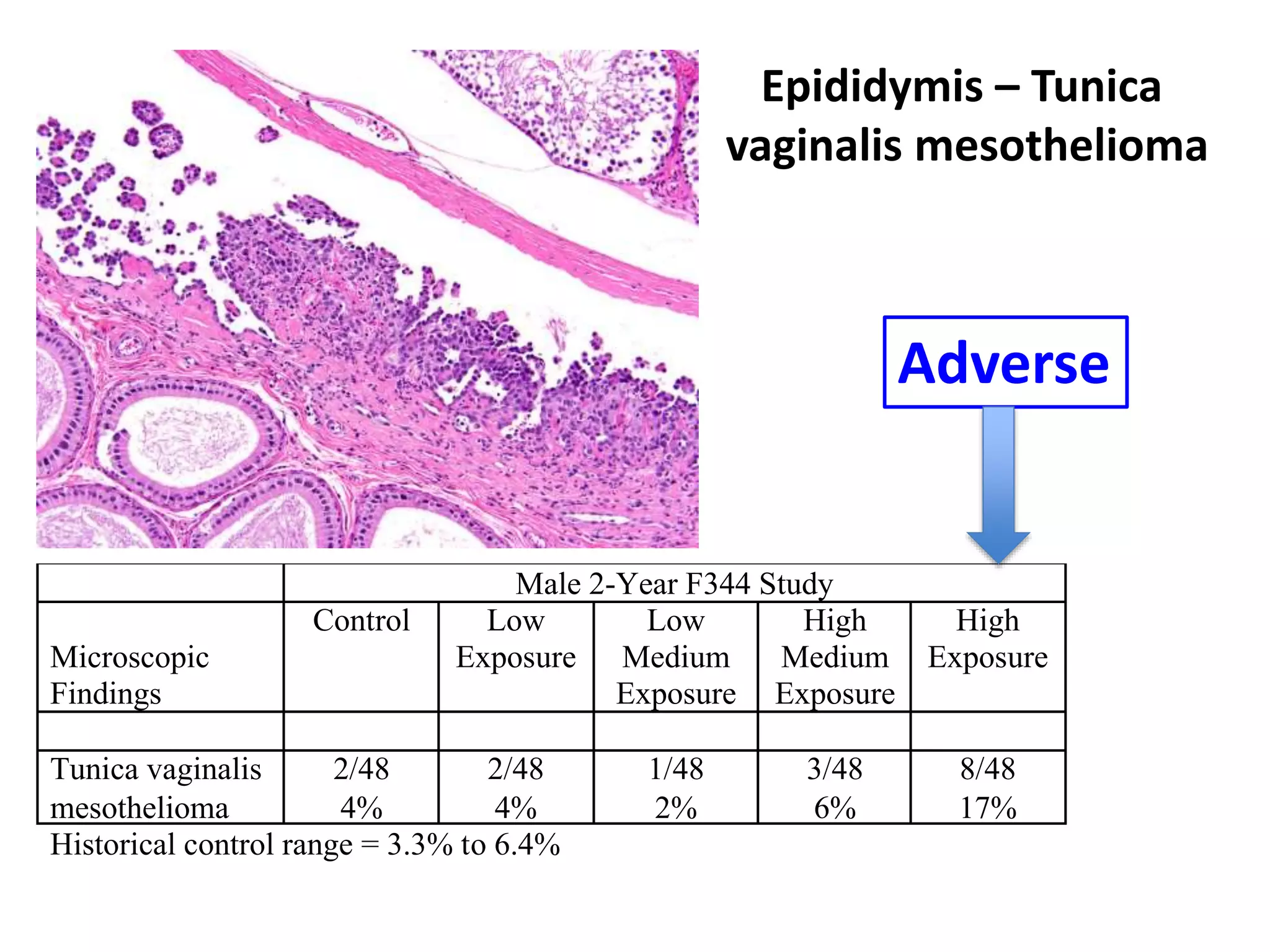 Epididymis – Tunica
vaginalis mesothelioma
Male 2-Year F344 Study
Microscopic
Findings
Control Low
Exposure
Low
Medium
Exposure
High
Medium
Exposure
High
Exposure
Tunica vaginalis
mesothelioma
2/48
4%
2/48
4%
1/48
2%
3/48
6%
8/48
17%
Historical control range = 3.3% to 6.4%
Adverse
 