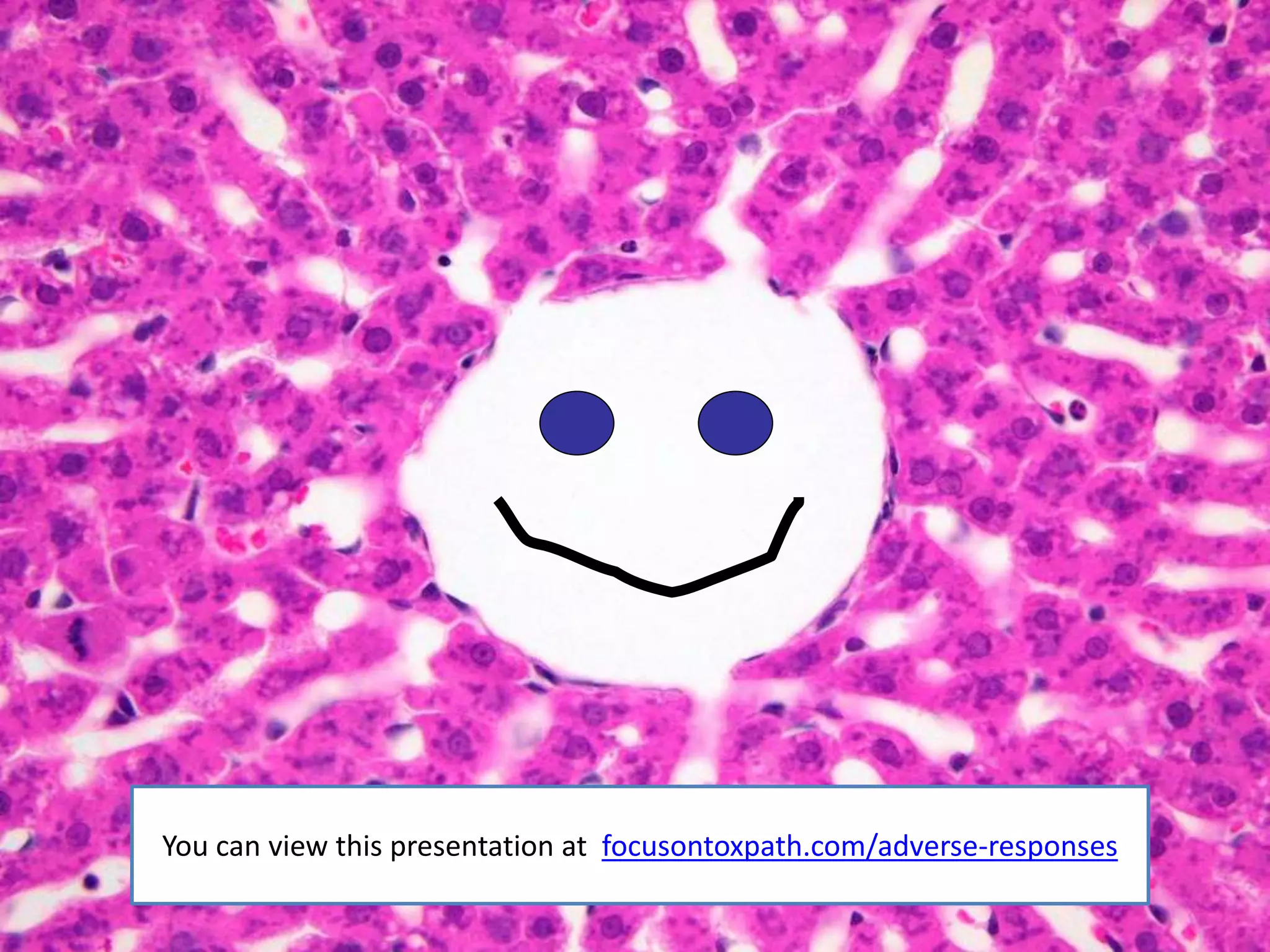 You can view this presentation at focusontoxpath.com/adverse-responses
 