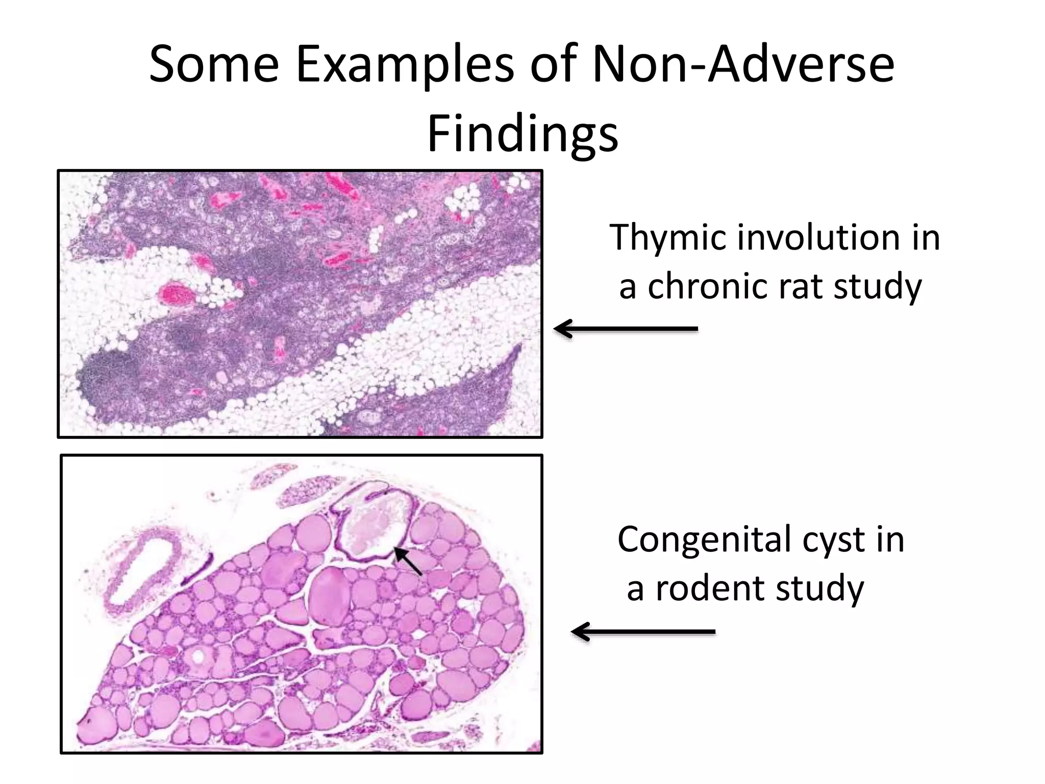 Some Examples of Non-Adverse
Findings
Thymic involution in
a chronic rat study
Congenital cyst in
a rodent study
 