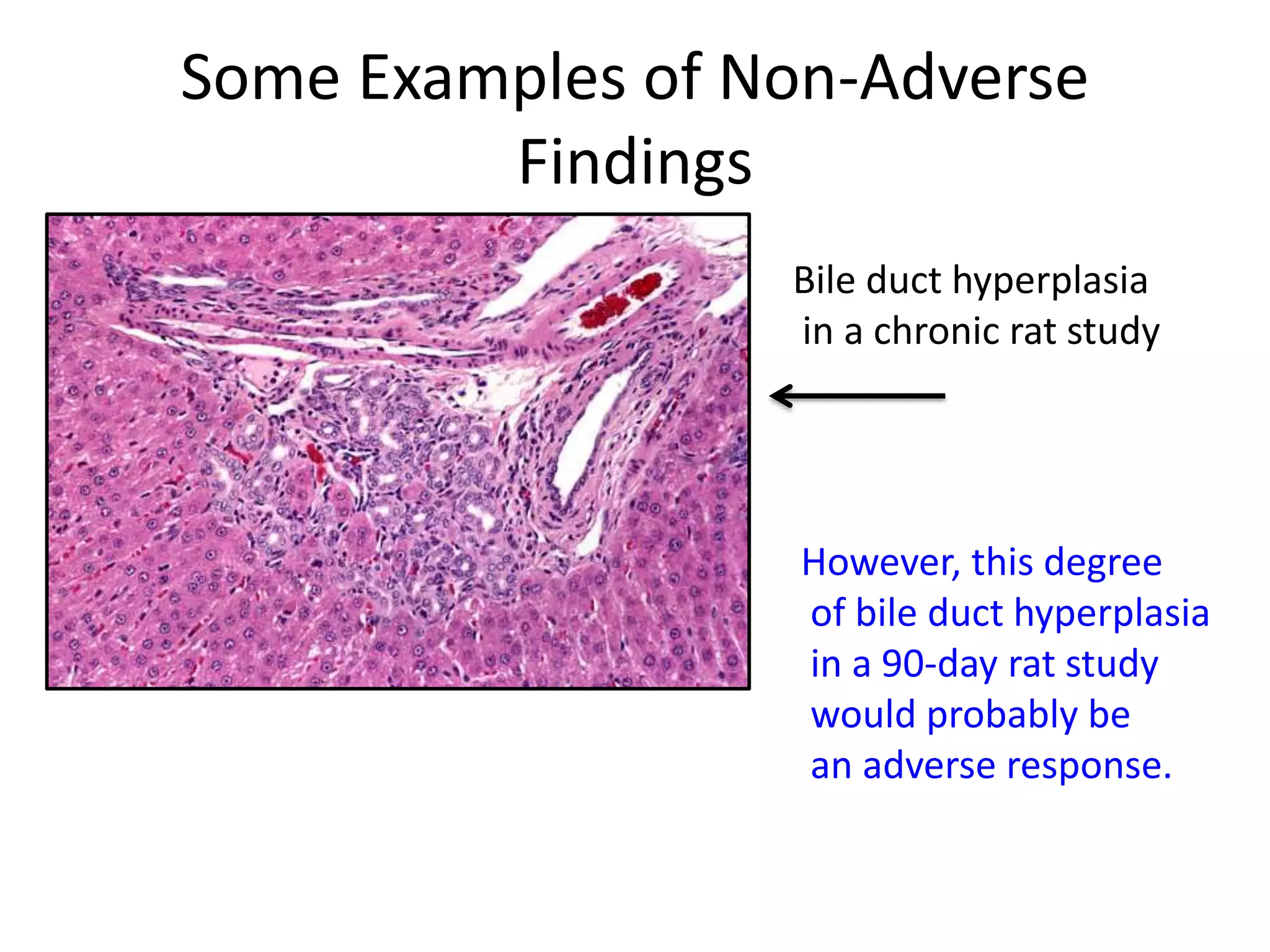 Some Examples of Non-Adverse
Findings
Bile duct hyperplasia
in a chronic rat study
However, this degree
of bile duct hyperplasia
in a 90-day rat study
would probably be
an adverse response.
 