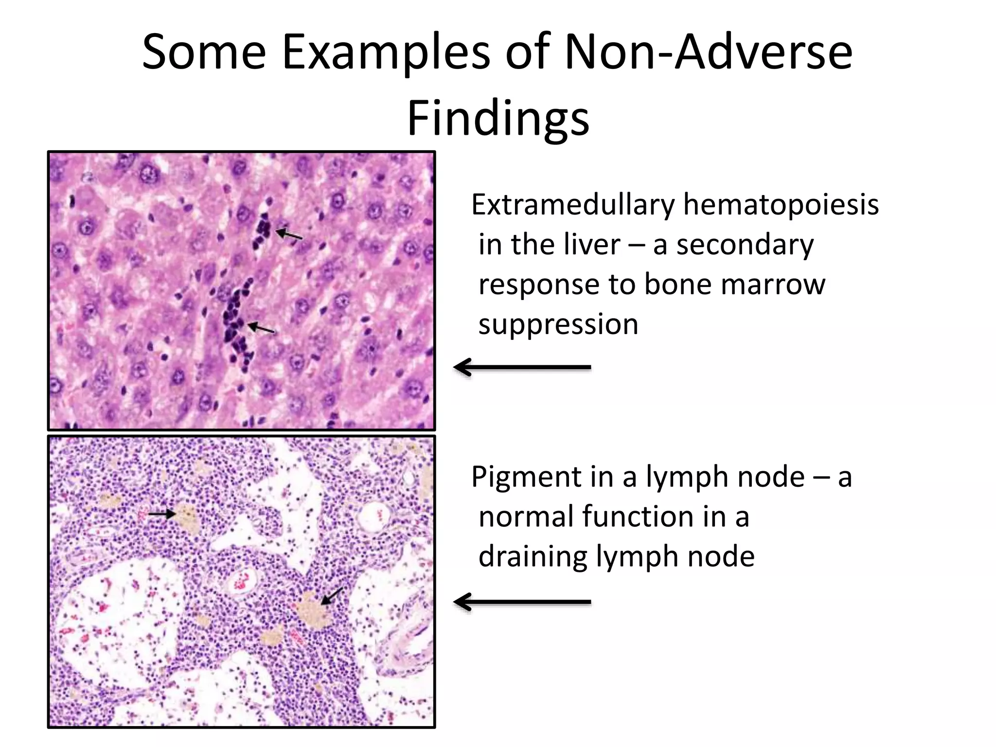 Some Examples of Non-Adverse
Findings
Extramedullary hematopoiesis
in the liver – a secondary
response to bone marrow
suppression
Pigment in a lymph node – a
normal function in a
draining lymph node
 