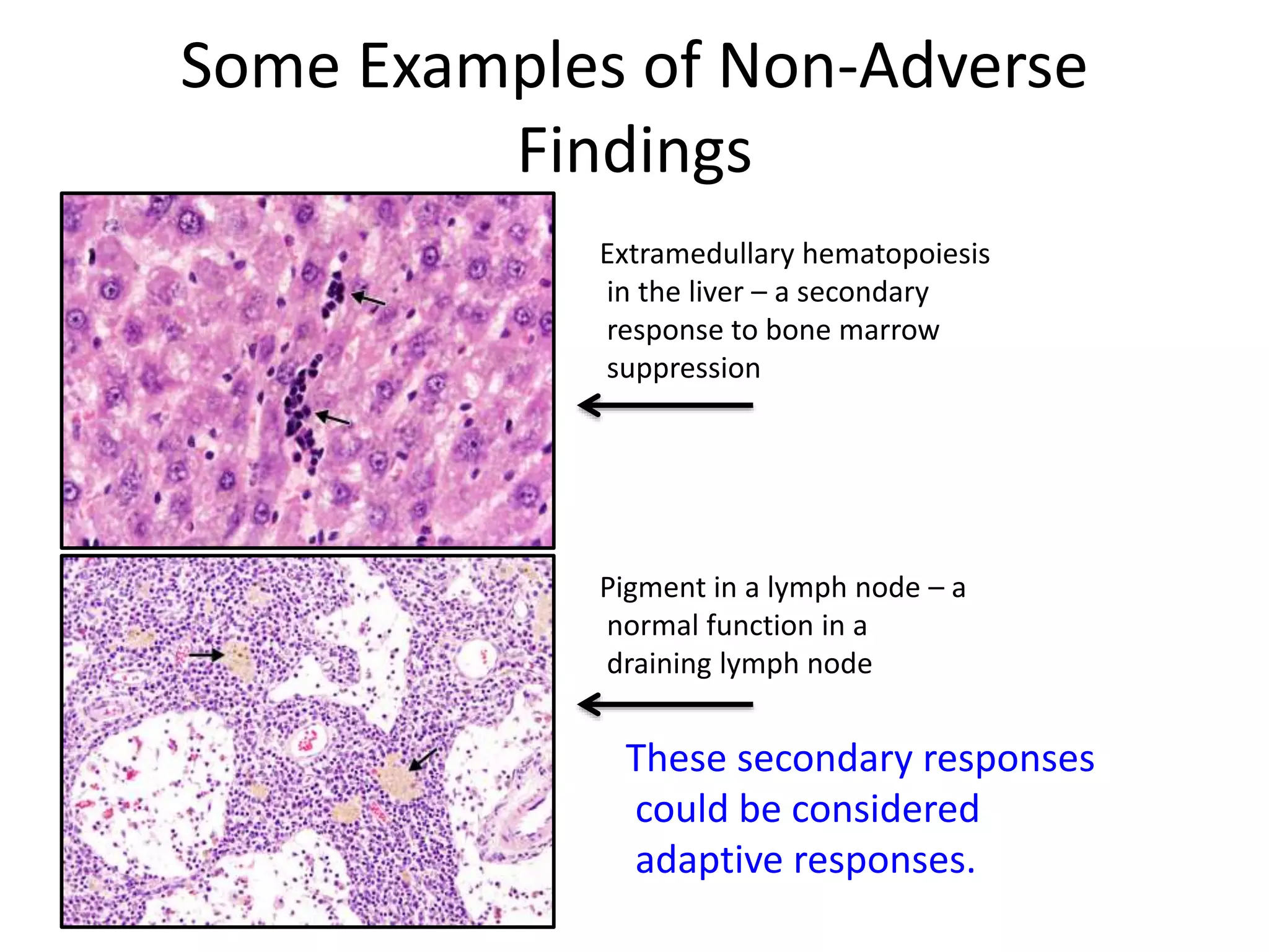 Some Examples of Non-Adverse
Findings
Extramedullary hematopoiesis
in the liver – a secondary
response to bone marrow
suppression
Pigment in a lymph node – a
normal function in a
draining lymph node
These secondary responses
could be considered
adaptive responses.
 