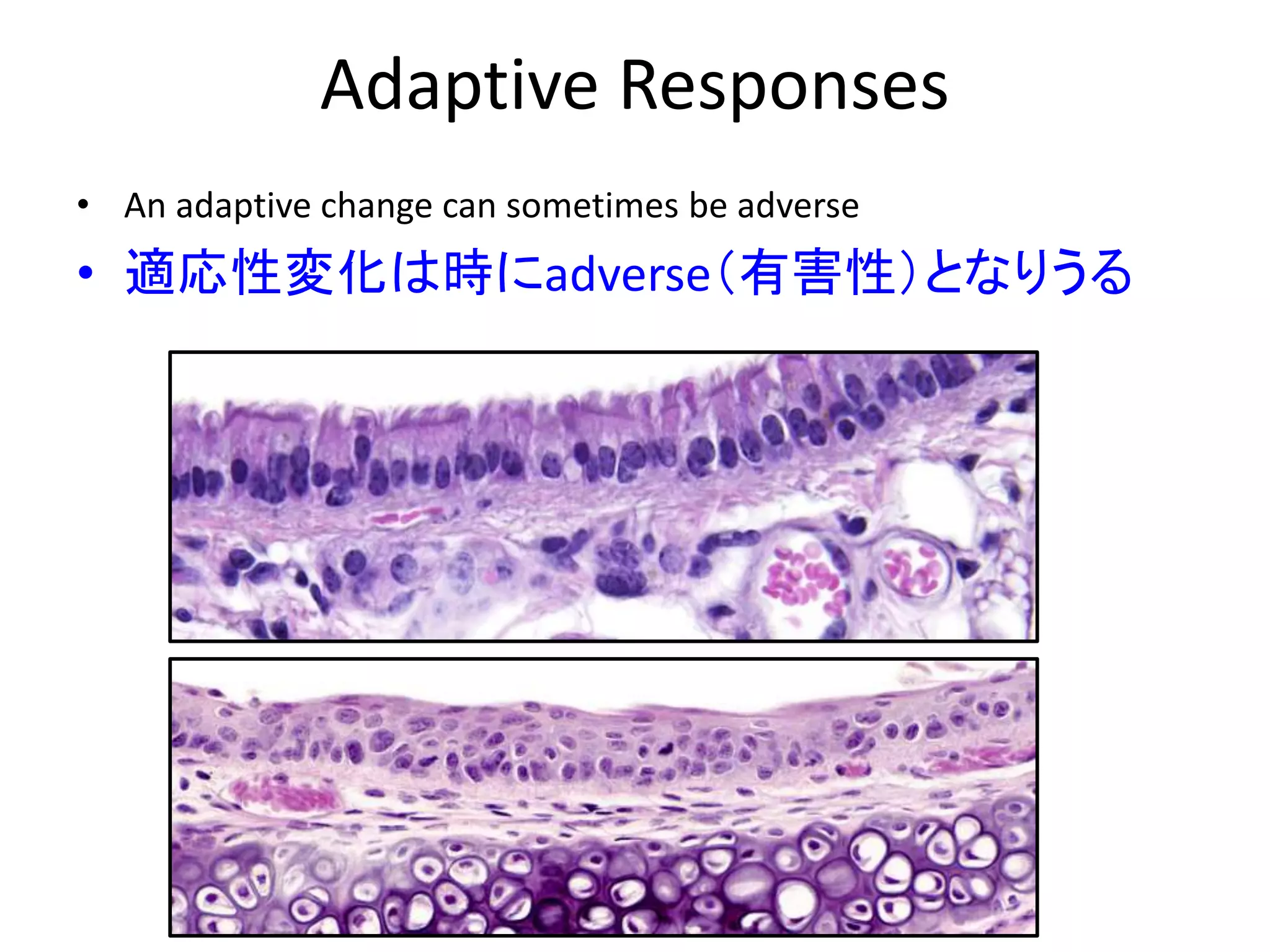 Adaptive Responses
• An adaptive change can sometimes be adverse
• 適応性変化は時にadverse（有害性）となりうる
 