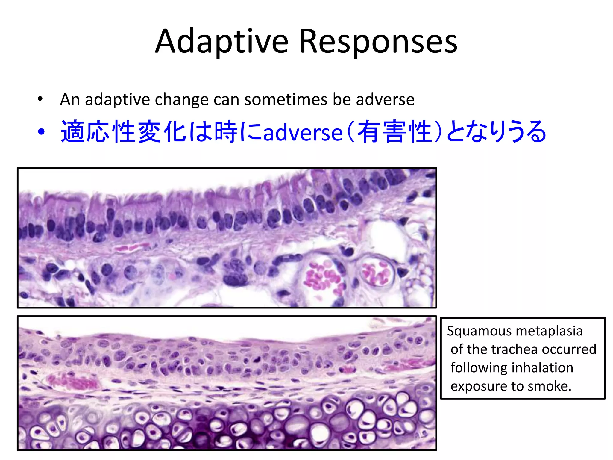 Adaptive Responses
• An adaptive change can sometimes be adverse
• 適応性変化は時にadverse（有害性）となりうる
Squamous metaplasia
of the trachea occurred
following inhalation
exposure to smoke.
 