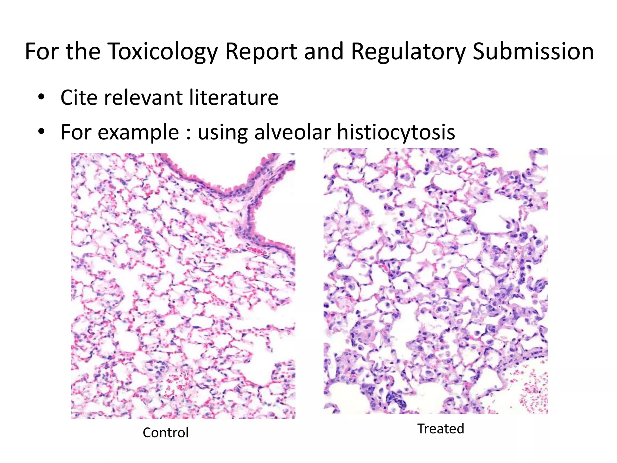 For the Toxicology Report and Regulatory Submission
• Cite relevant literature
• For example : using alveolar histiocytosis
Control Treated
 