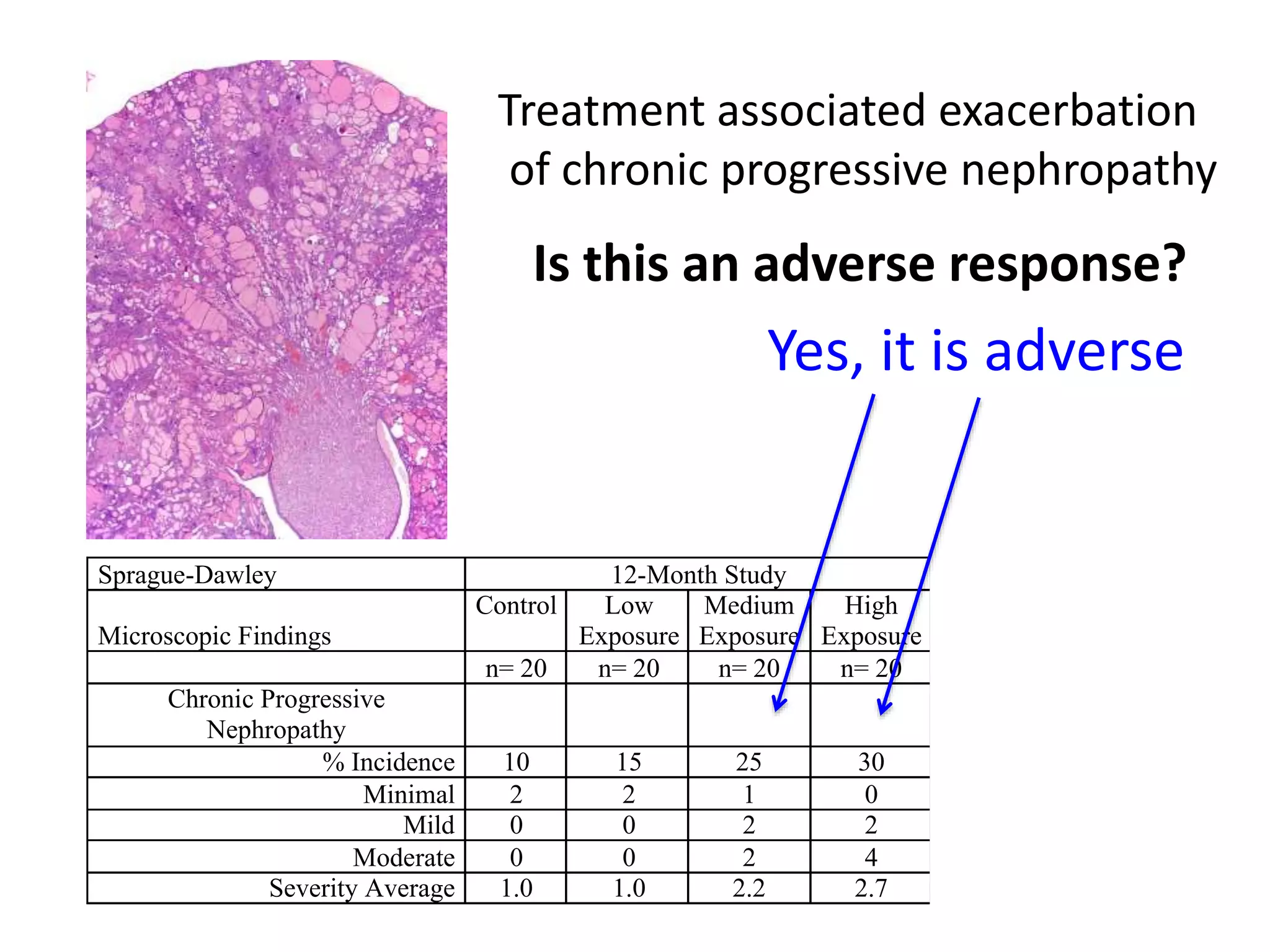 Sprague-Dawley 12-Month Study
Microscopic Findings
Control Low
Exposure
Medium
Exposure
High
Exposure
n= 20 n= 20 n= 20 n= 20
Chronic Progressive
Nephropathy
% Incidence 10 15 25 30
Minimal 2 2 1 0
Mild 0 0 2 2
Moderate 0 0 2 4
Severity Average 1.0 1.0 2.2 2.7
Treatment associated exacerbation
of chronic progressive nephropathy
Is this an adverse response?
Yes, it is adverse
 