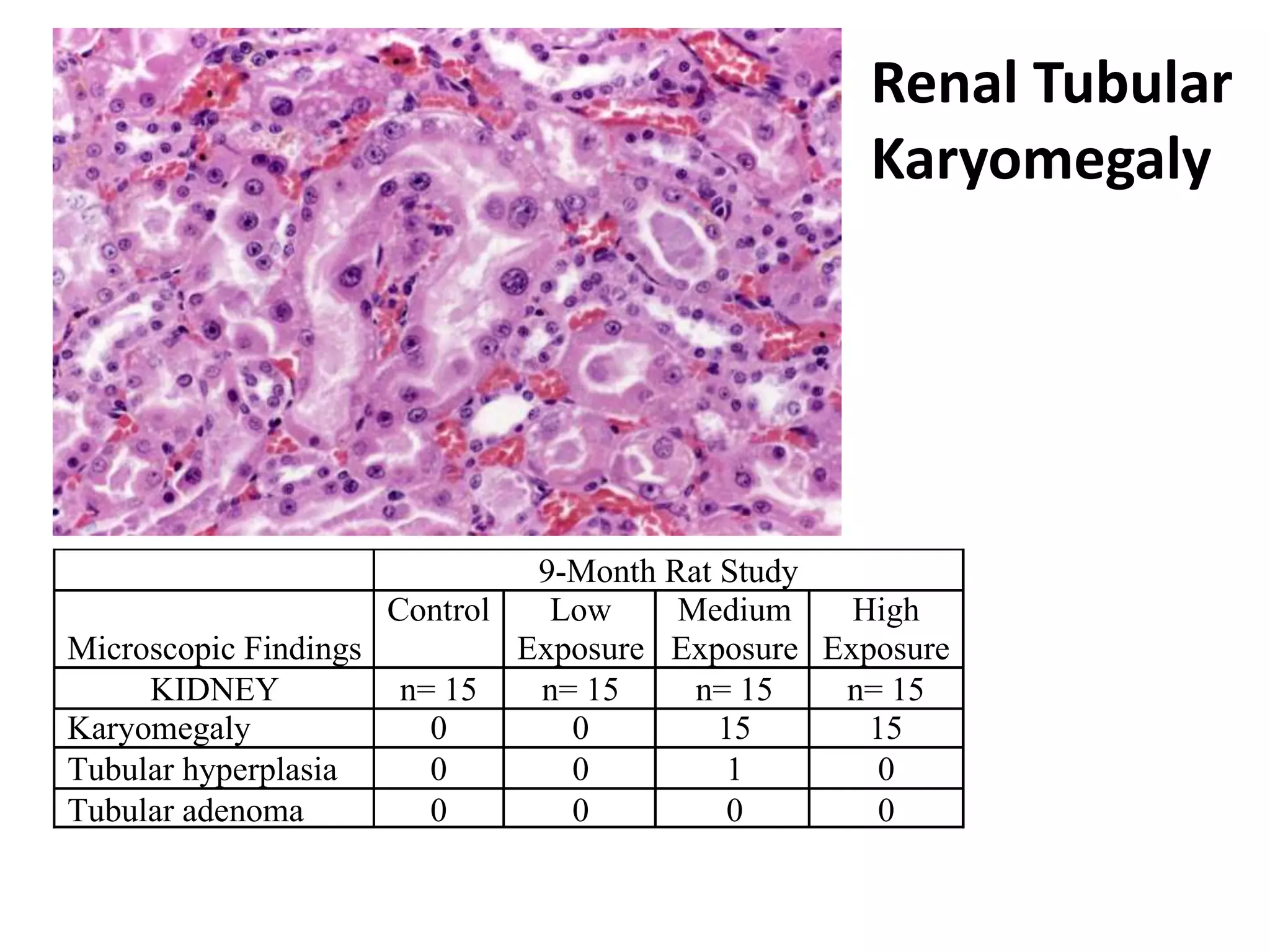 9-Month Rat Study
Microscopic Findings
Control Low
Exposure
Medium
Exposure
High
Exposure
KIDNEY n= 15 n= 15 n= 15 n= 15
Karyomegaly 0 0 15 15
Tubular hyperplasia 0 0 1 0
Tubular adenoma 0 0 0 0
Renal Tubular
Karyomegaly
 