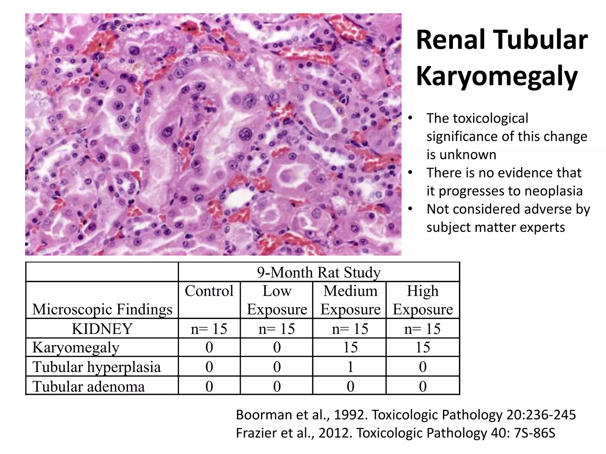 9-Month Rat Study
Microscopic Findings
Control Low
Exposure
Medium
Exposure
High
Exposure
KIDNEY n= 15 n= 15 n= 15 n= 15
Karyomegaly 0 0 15 15
Tubular hyperplasia 0 0 1 0
Tubular adenoma 0 0 0 0
Renal Tubular
Karyomegaly
Boorman et al., 1992. Toxicologic Pathology 20:236-245
Frazier et al., 2012. Toxicologic Pathology 40: 7S-86S
• The toxicological
significance of this change
is unknown
• There is no evidence that
it progresses to neoplasia
• Not considered adverse by
subject matter experts
 