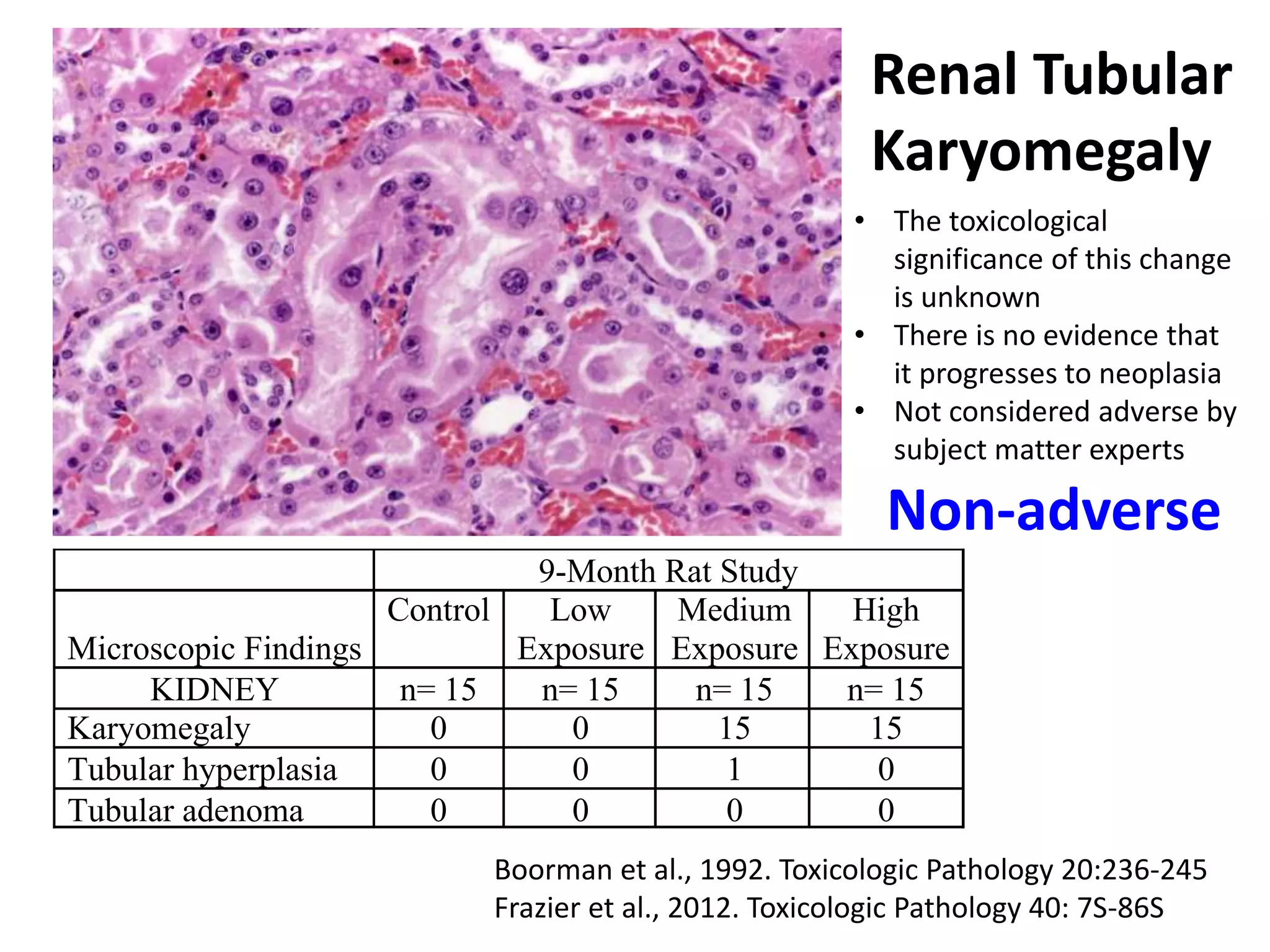 9-Month Rat Study
Microscopic Findings
Control Low
Exposure
Medium
Exposure
High
Exposure
KIDNEY n= 15 n= 15 n= 15 n= 15
Karyomegaly 0 0 15 15
Tubular hyperplasia 0 0 1 0
Tubular adenoma 0 0 0 0
Renal Tubular
Karyomegaly
Boorman et al., 1992. Toxicologic Pathology 20:236-245
Frazier et al., 2012. Toxicologic Pathology 40: 7S-86S
• The toxicological
significance of this change
is unknown
• There is no evidence that
it progresses to neoplasia
• Not considered adverse by
subject matter experts
Non-adverse
 