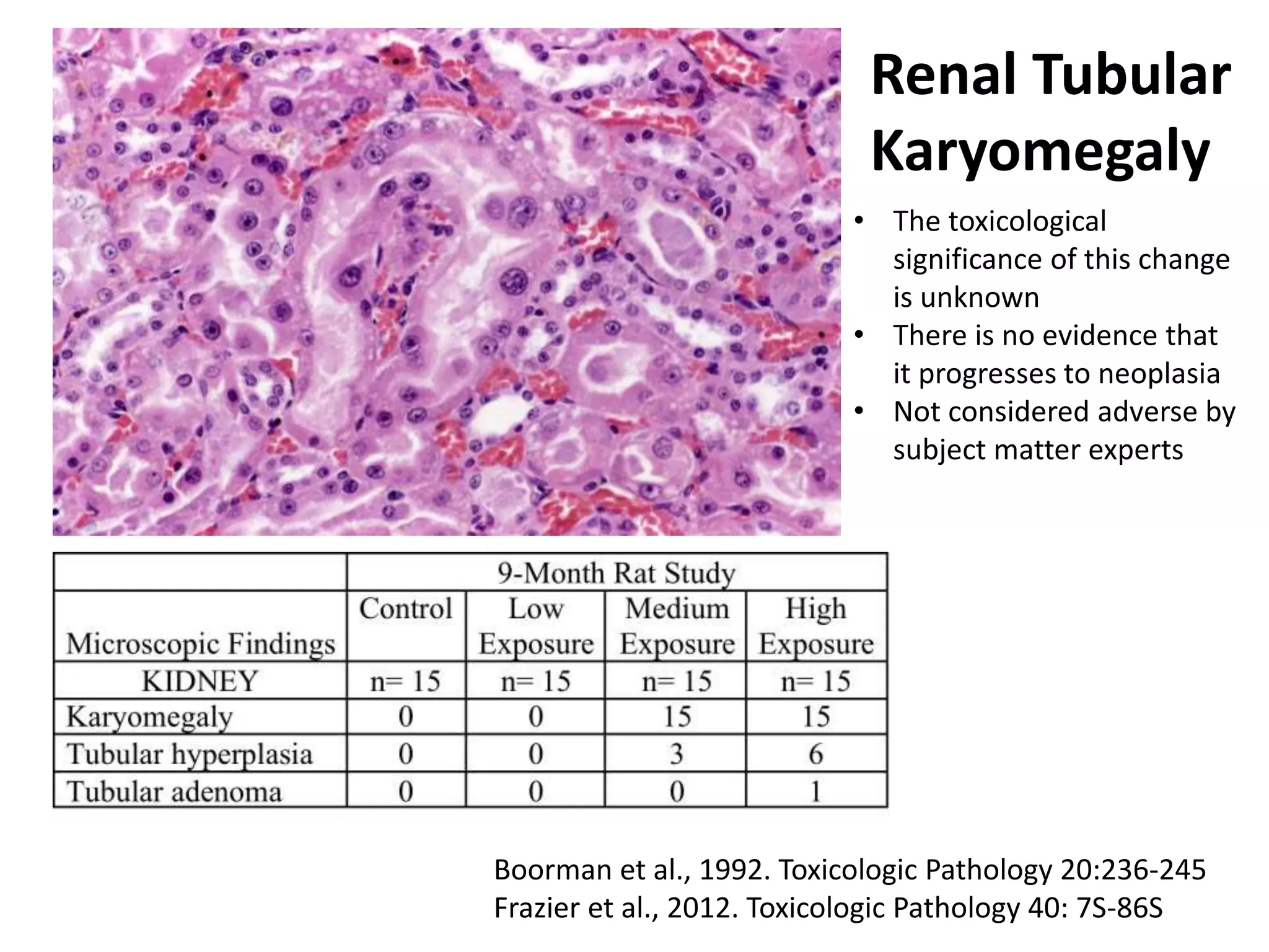 Renal Tubular
Karyomegaly
Boorman et al., 1992. Toxicologic Pathology 20:236-245
Frazier et al., 2012. Toxicologic Pathology 40: 7S-86S
• The toxicological
significance of this change
is unknown
• There is no evidence that
it progresses to neoplasia
• Not considered adverse by
subject matter experts
 